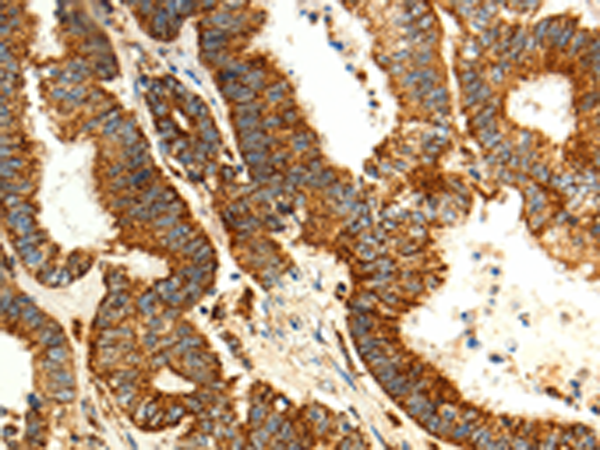 Rabbit Polyclonal Antibody to MAP1LC3A