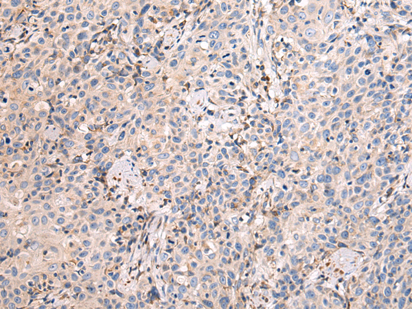 Rabbit Polyclonal Antibody to MAP3K9