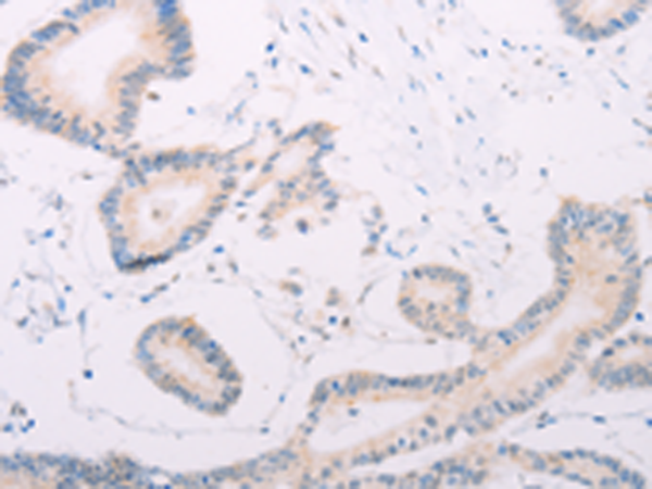 Rabbit Polyclonal Antibody to MAP3K12