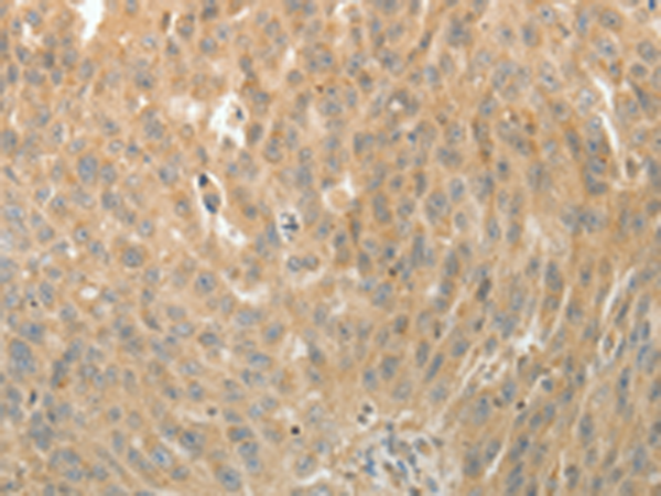 Rabbit Polyclonal Antibody to MAP4