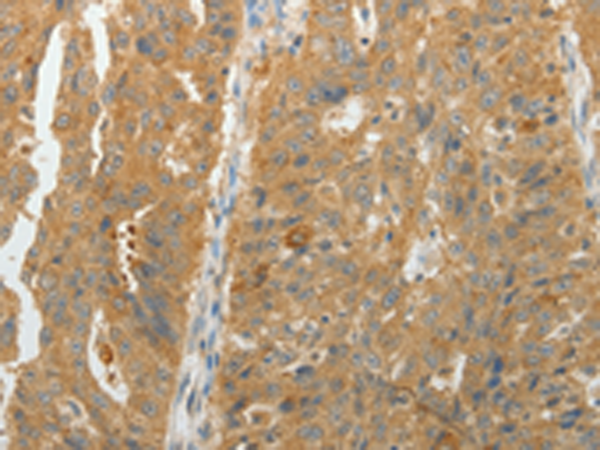 Rabbit Polyclonal Antibody to MAP4K5