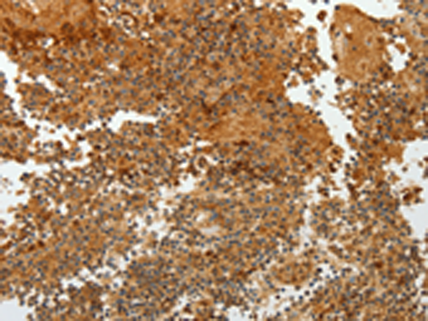 Rabbit Polyclonal Antibody to TFF2