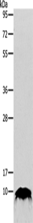 Rabbit Polyclonal Antibody to TFF1