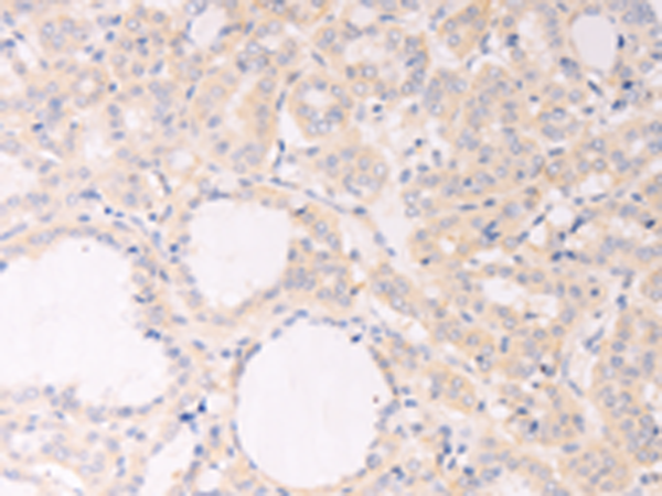 Rabbit Polyclonal Antibody to F7