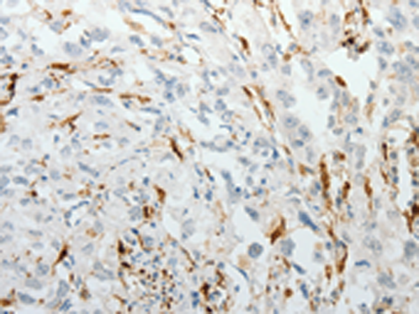 Rabbit Polyclonal Antibody to F13A1
