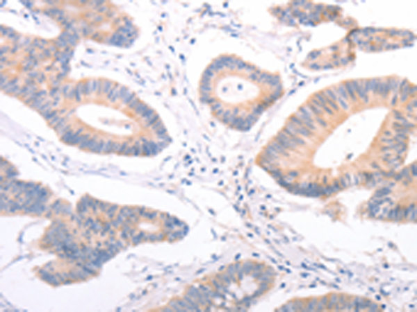 Rabbit Polyclonal Antibody to F9