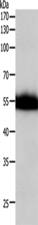 Rabbit Polyclonal Antibody to F10