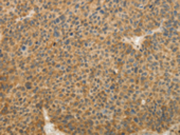 Rabbit Polyclonal Antibody to TFPI2