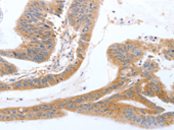 Rabbit Polyclonal Antibody to TGFA