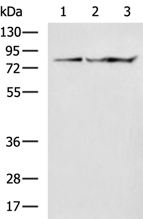 Rabbit Polyclonal Antibody to TGM2