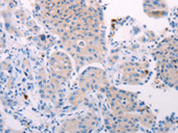 Rabbit Polyclonal Antibody to TEKT4
