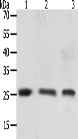 Rabbit Polyclonal Antibody to TIMP4