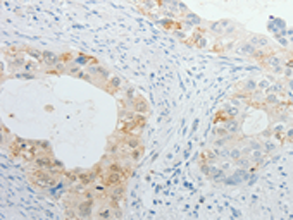 Rabbit Polyclonal Antibody to TIMP1