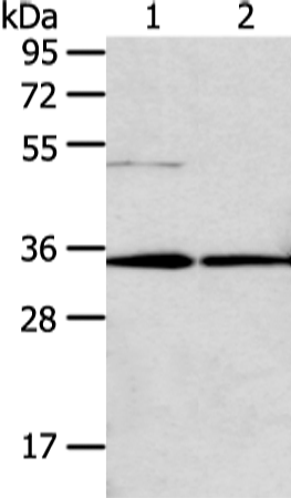 Rabbit Polyclonal Antibody to TNFAIP1