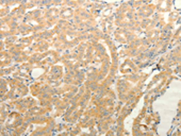Rabbit Polyclonal Antibody to TPH1