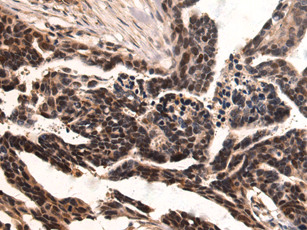 Rabbit Polyclonal Antibody to TRADD