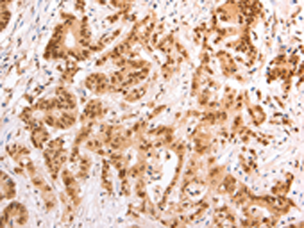 Rabbit Polyclonal Antibody to TAX1BP1