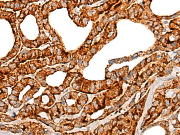 Rabbit Polyclonal Antibody to TNFSF10
