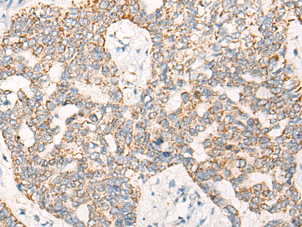 Rabbit Polyclonal Antibody to NTRK2