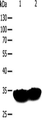 Rabbit Polyclonal Antibody to TPM1