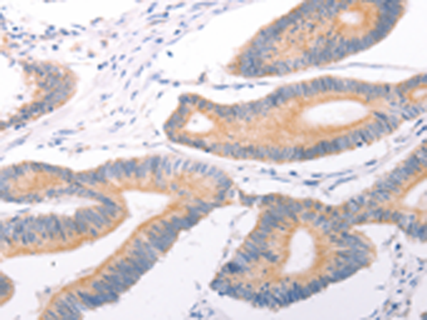 Rabbit Polyclonal Antibody to TRPC7