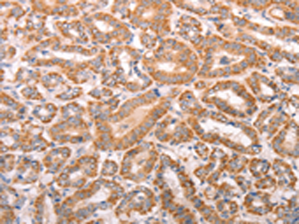 Rabbit Polyclonal Antibody to TRPV4