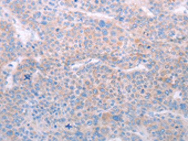 Rabbit Polyclonal Antibody to SPATA6