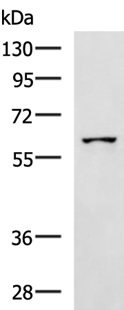 Rabbit Polyclonal Antibody to SPATA16