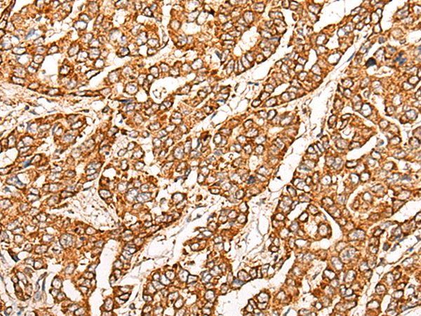 Rabbit Polyclonal Antibody to SPATA19
