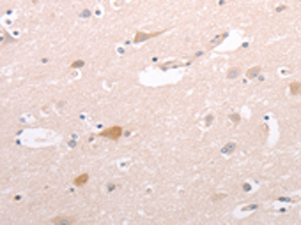 Rabbit Polyclonal Antibody to CIDEB
