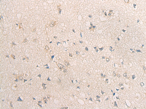 Rabbit Polyclonal Antibody to TSG101