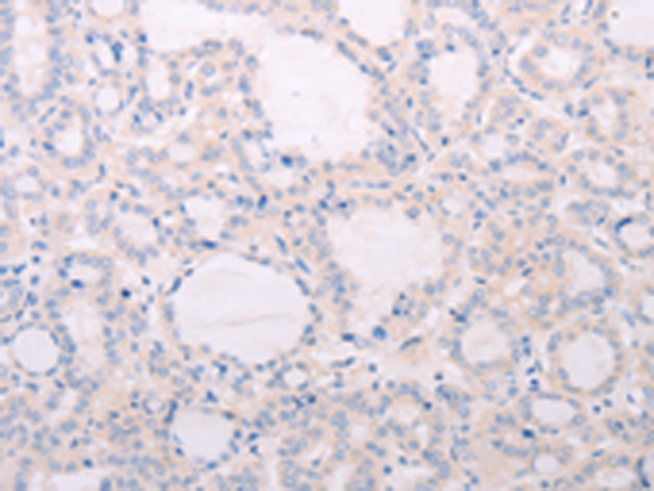 Rabbit Polyclonal Antibody to TSHR
