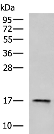 Rabbit Polyclonal Antibody to TSLP
