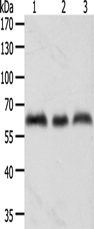 Rabbit Polyclonal Antibody to TYR