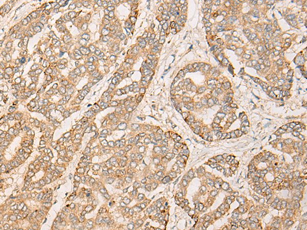 Rabbit Polyclonal Antibody to VPS18