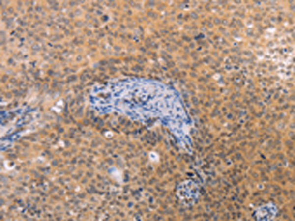 Rabbit Polyclonal Antibody to VHL