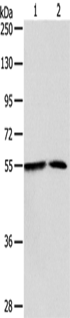 Rabbit Polyclonal Antibody to NAMPT