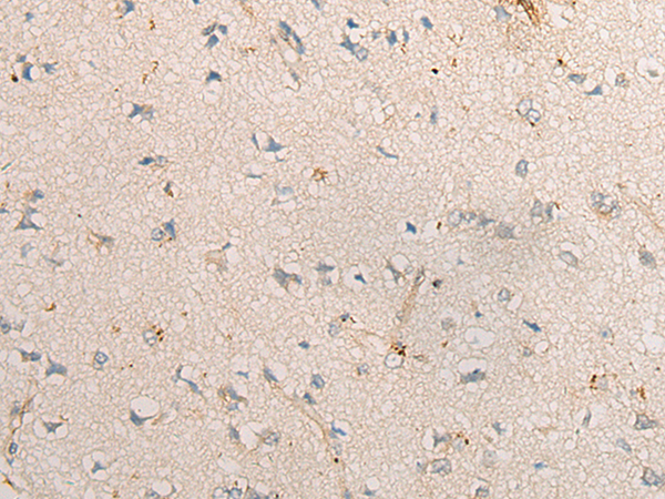 Rabbit Polyclonal Antibody to PPM1D