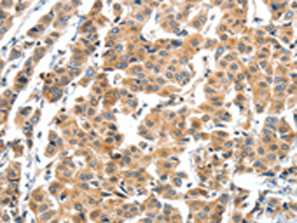 Rabbit Polyclonal Antibody to XBP1