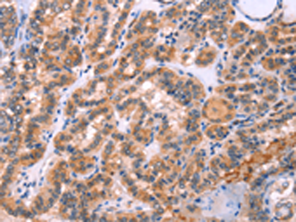 Rabbit Polyclonal Antibody to STXBP2