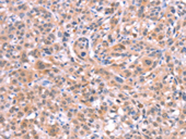 Rabbit Polyclonal Antibody to BMPR2