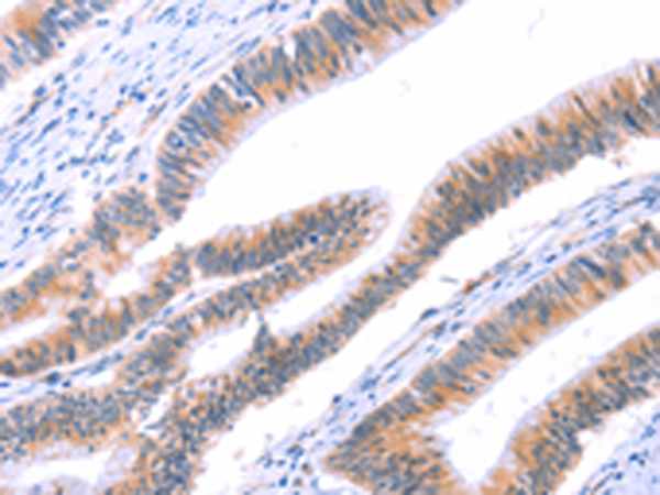 Rabbit Polyclonal Antibody to VWF