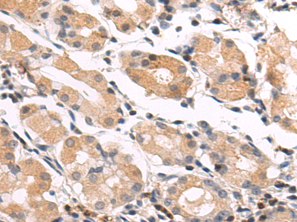 Rabbit Polyclonal Antibody to VDR