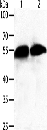 Rabbit Polyclonal Antibody to GC