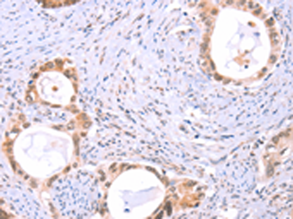 Rabbit Polyclonal Antibody to PROS1