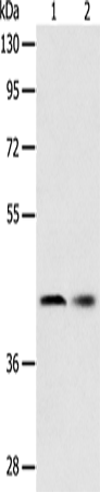 Rabbit Polyclonal Antibody to SERPINA5
