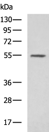 Rabbit Polyclonal Antibody to SUFU