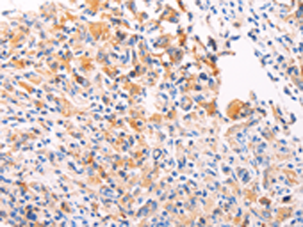 Rabbit Polyclonal Antibody to PGBD1