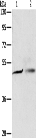 Rabbit Polyclonal Antibody to PGBD4