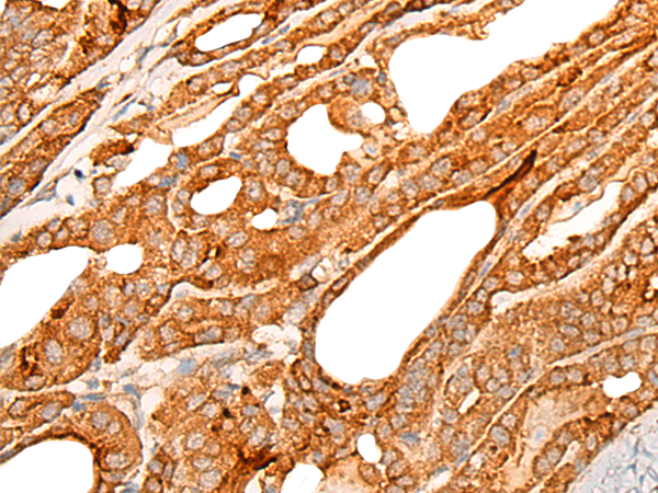 Rabbit Polyclonal Antibody to TMEM67